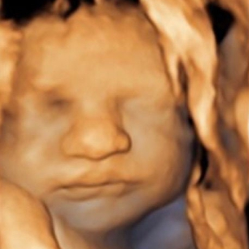 Original ultrasound 1